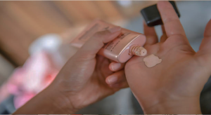 Bagaimana-cara-untuk-menutup-parut-jerawat-serta-kekurangan-yang-ada-di-wajah-anda